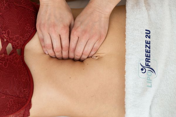 diastasis recti treatment Warrington