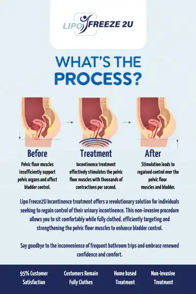 Diagram of how incontinence treatment Warrington works.