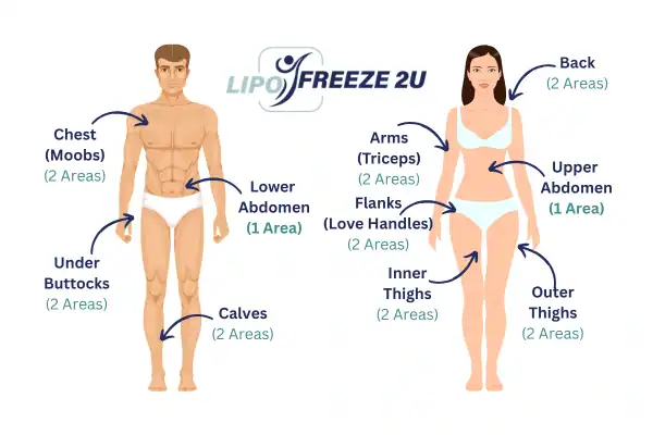 Areas you can have fat freezing treatment Warrington