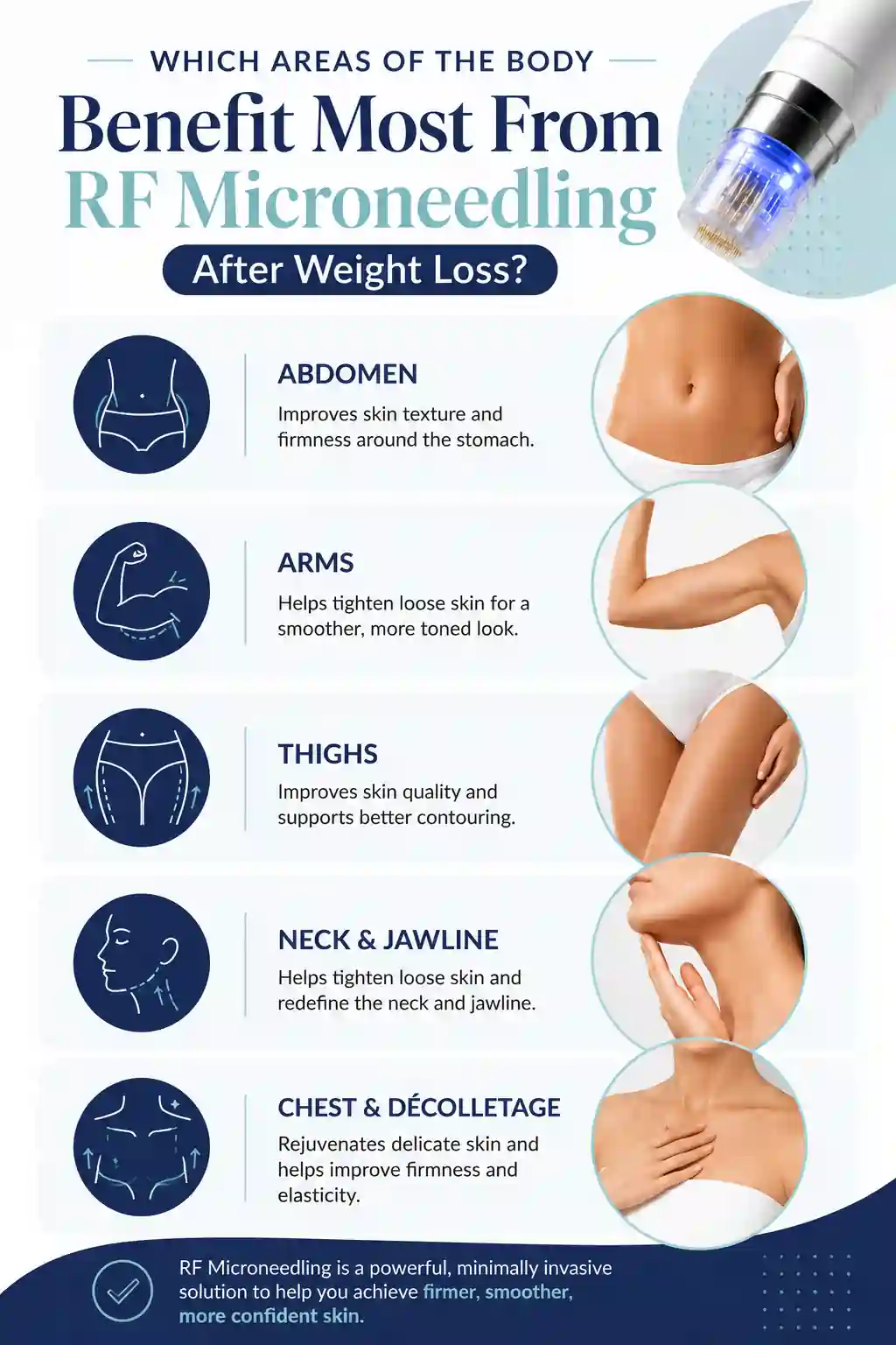 Which Areas of the Body Benefit Most From RF Microneedling After Weight Loss Warrington